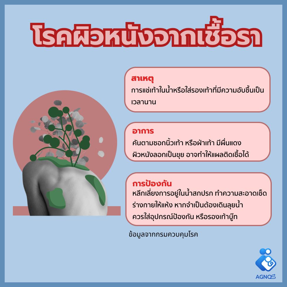 โรคผิวหนังจากเชื้อรา