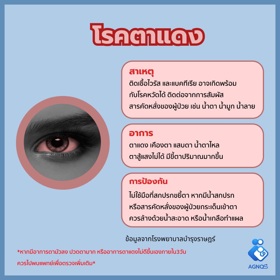โรคตาแดง