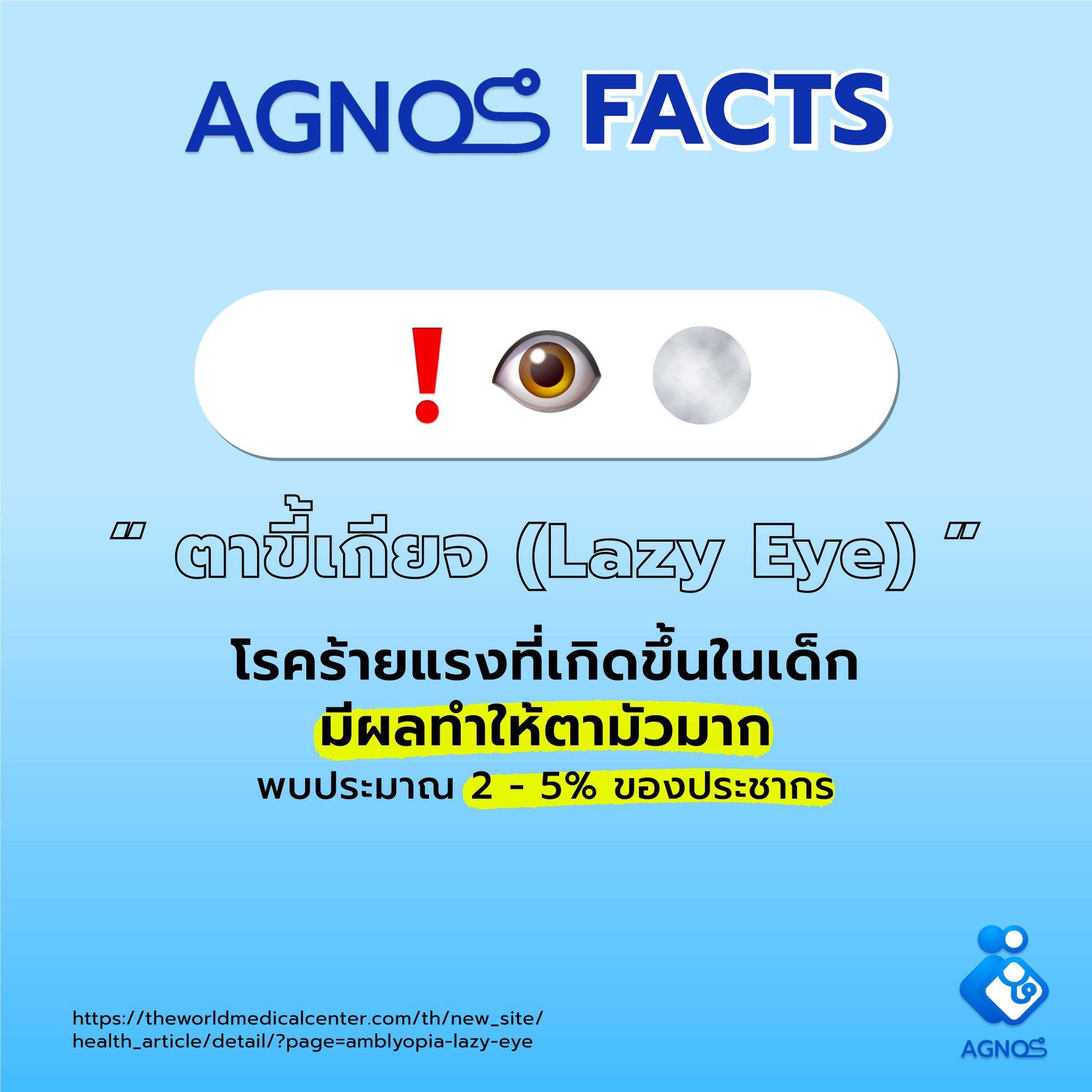 ตาขี้เกียจ