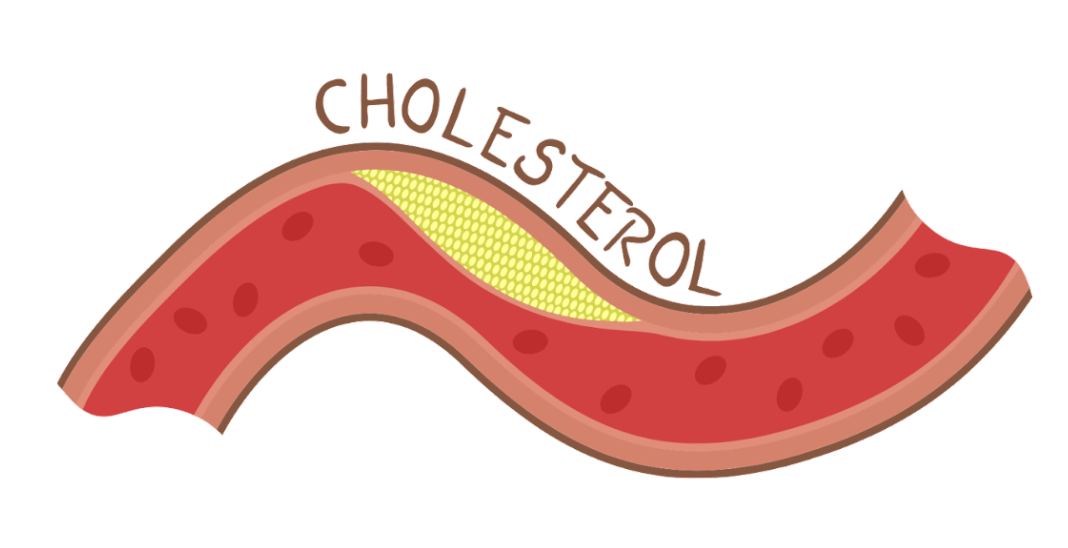 คอเลสเตอรอล (cholesterol)