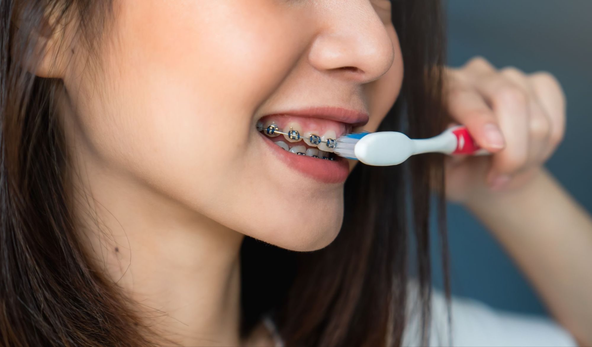 How to Take Care of Your Braces: 7 Dentist-Recommended Tips for Maintaining Oral Health