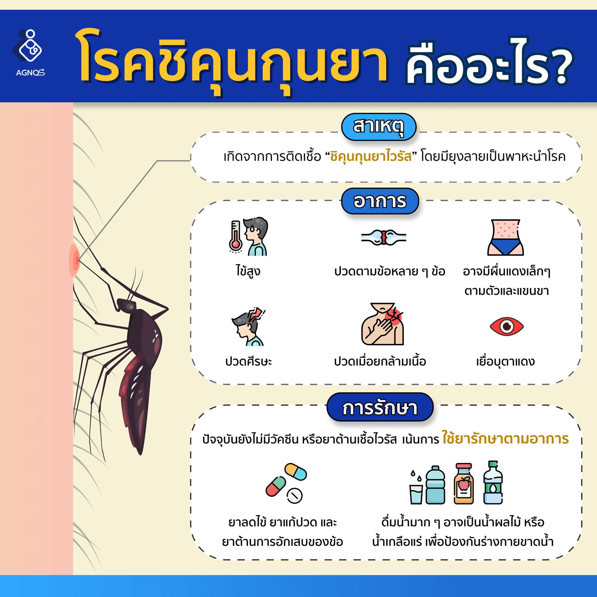 โรคชิคุนกุนยา คืออะไร?