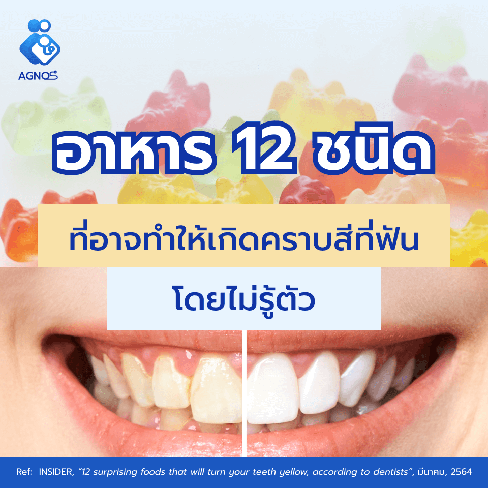 คราบสีที่ฟัน อาหาร