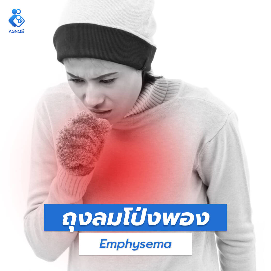ถุงลมโป่งพอง (Emphysema)