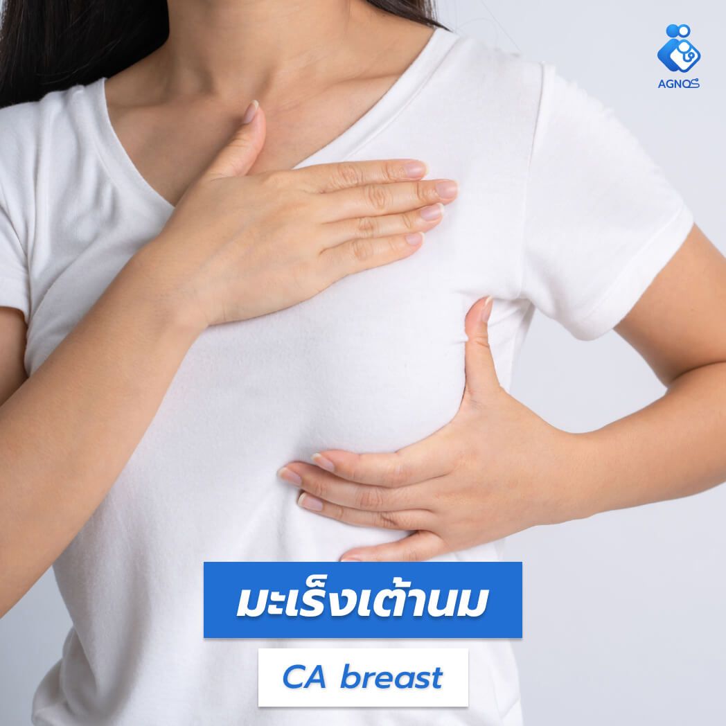 มะเร็งเต้านม (Breast cancer)