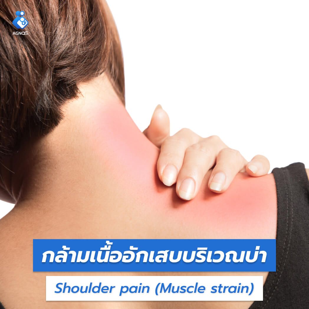กล้ามเนื้ออักเสบบริเวณบ่า
(Shoulder pain (Muscle strain))