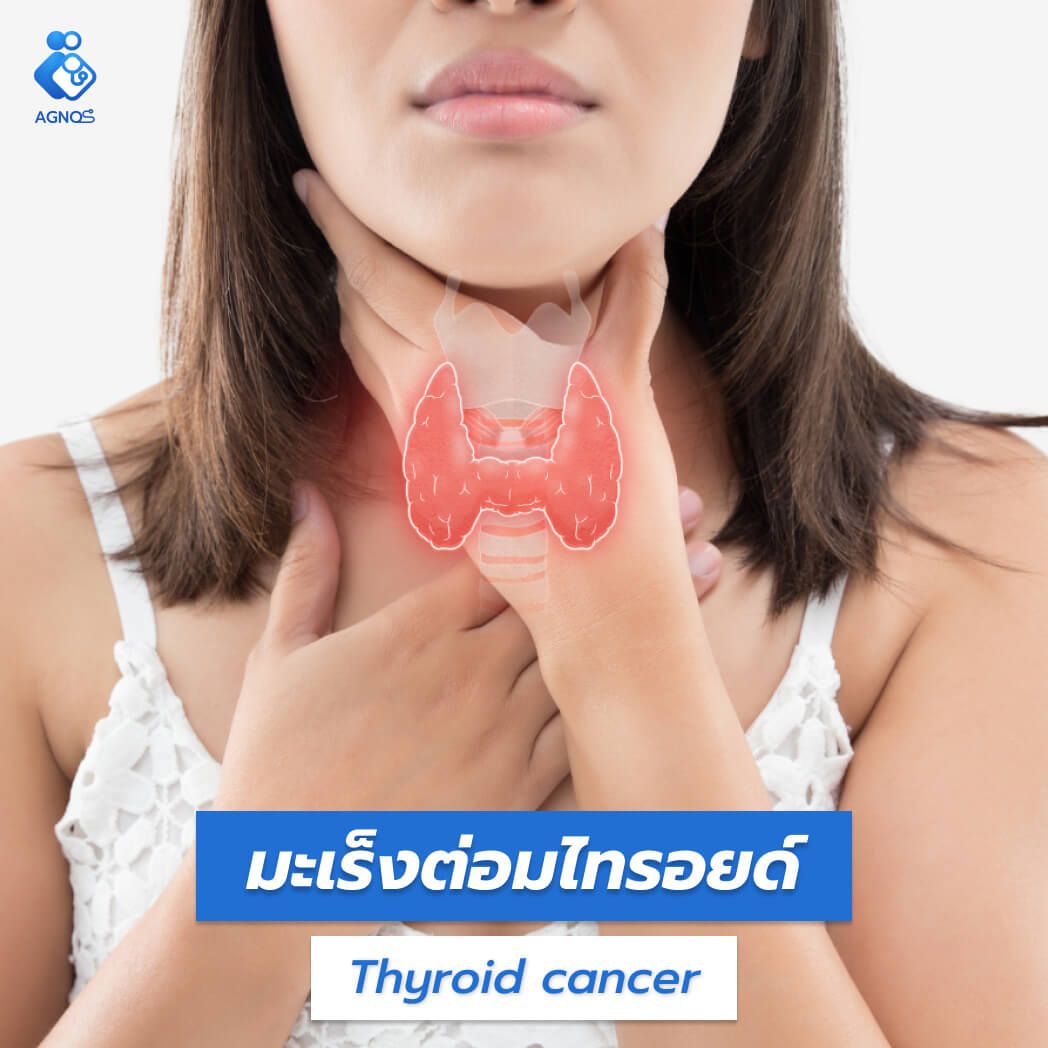 มะเร็งต่อมไทรอยด์ (Thyroid cancer)