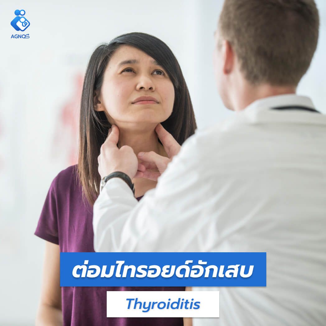 ต่อมไทรอยด์อักเสบ (Thyroiditis)