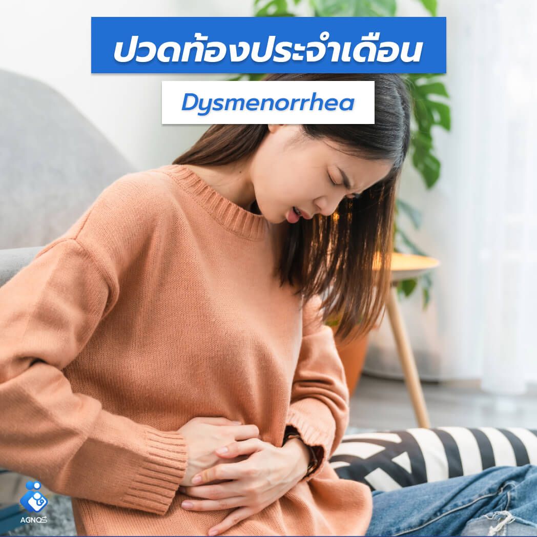 ปวดท้องประจำเดือน (Dysmenorrhea unspecified)