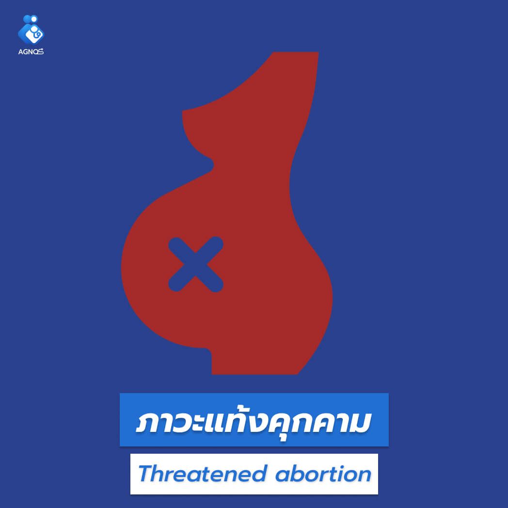 ภาวะแท้งคุกคาม (Threatened abortion)