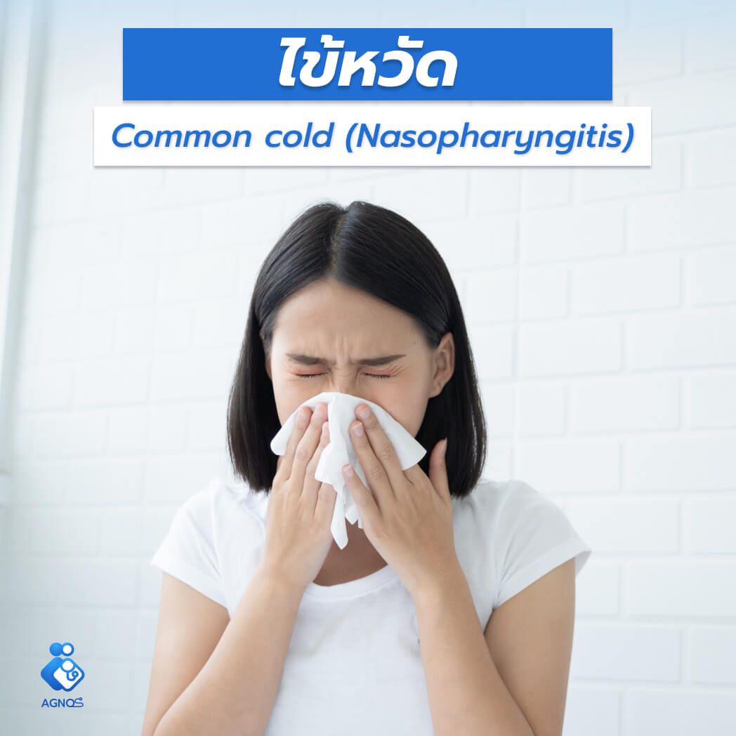 ไข้หวัด (Common cold
(Nasopharyngitis))