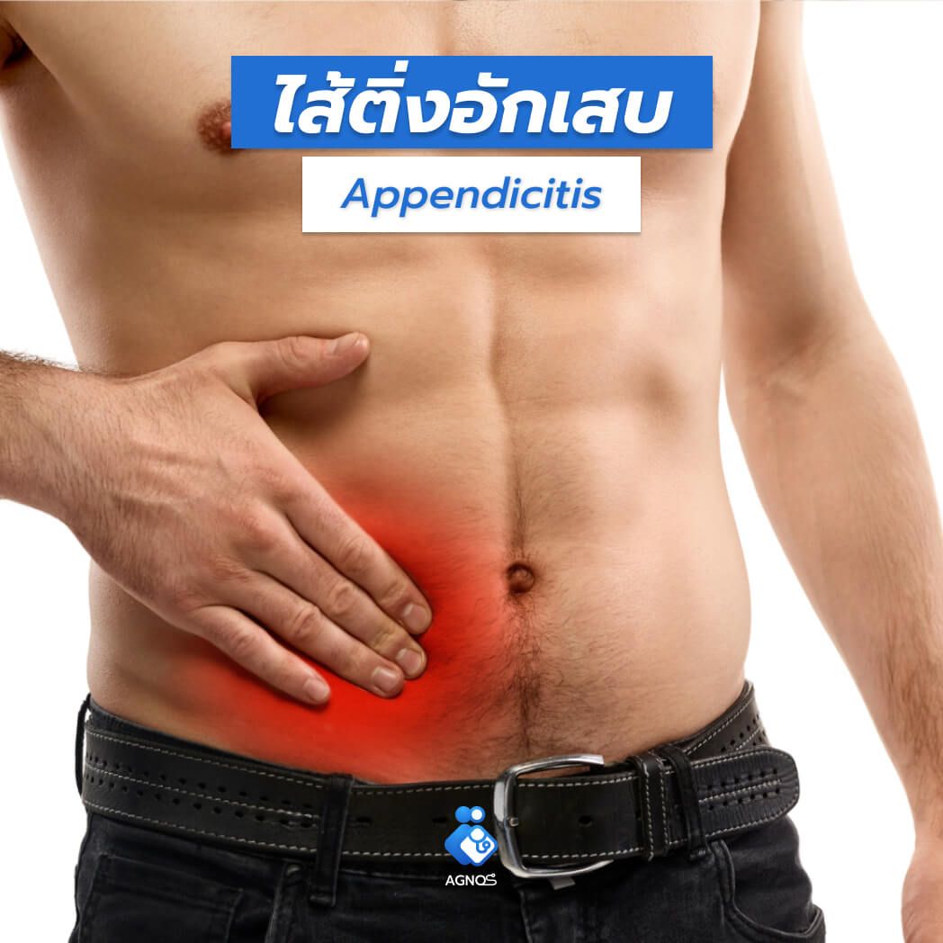 ไส้ติ่งอักเสบ (Appendicitis)