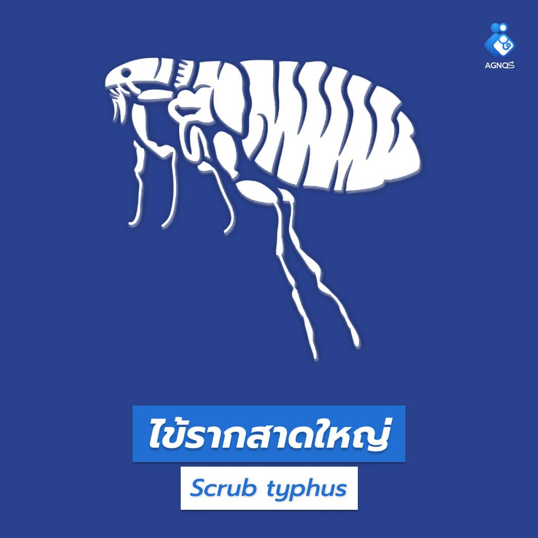ไข้รากสาดใหญ่ (Scrub typhus)