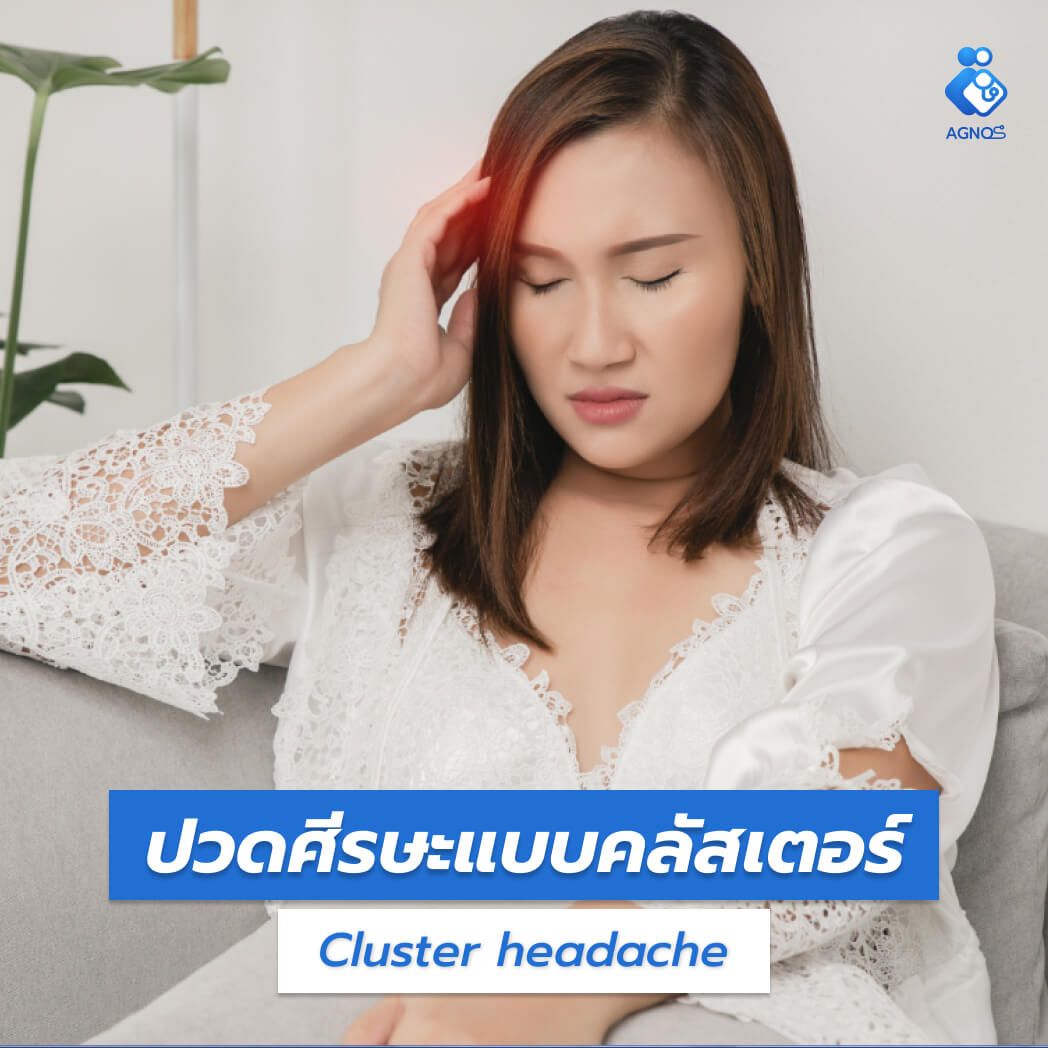 ปวดศีรษะแบบคลัสเตอร์ (Cluster
headache)