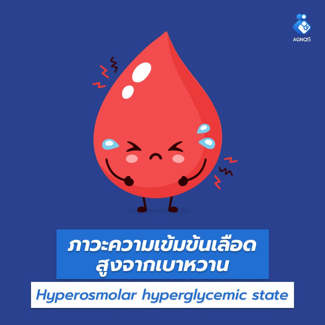 ภาวะความเข้มข้นเลือดสูงจากเบาหวาน
(Hyperosmolar hyperglycemic state)