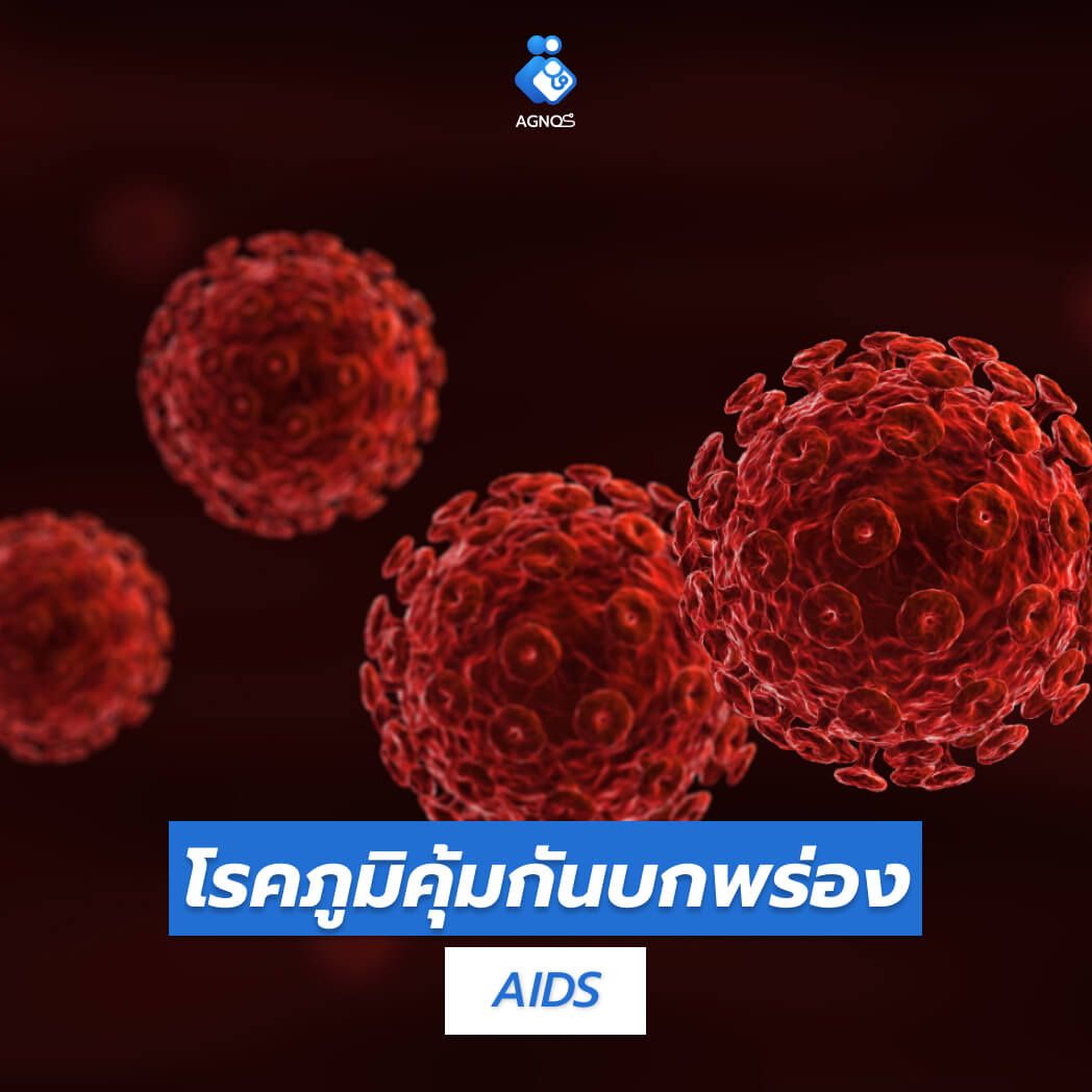 โรคภูมิคุ้มกันบกพร่อง (AIDS)