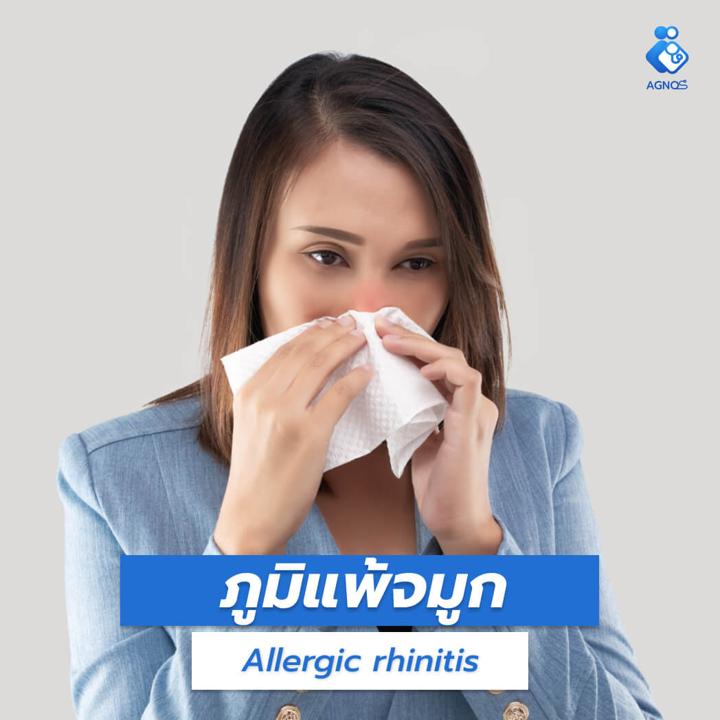 โรคภูมิแพ้จมูก (Allergic
rhinitis)