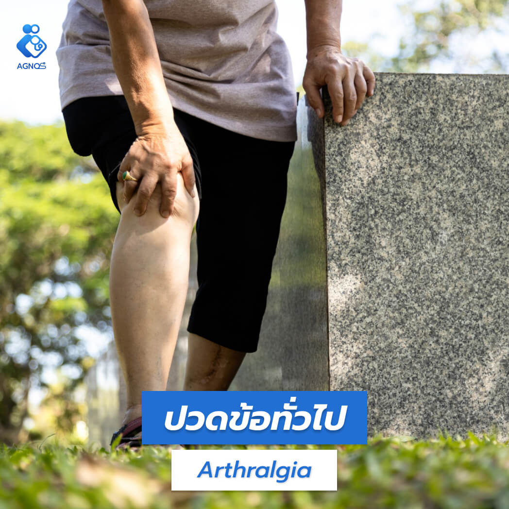 ปวดข้อทั่วไป (Arthralgia)
