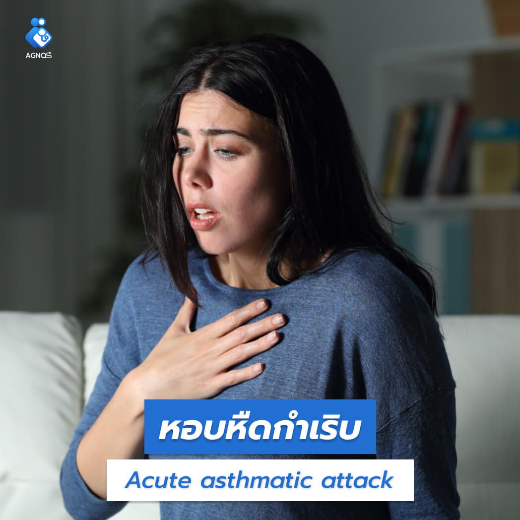 หอบหืดกำเริบ (Acute asthmatic
attack)