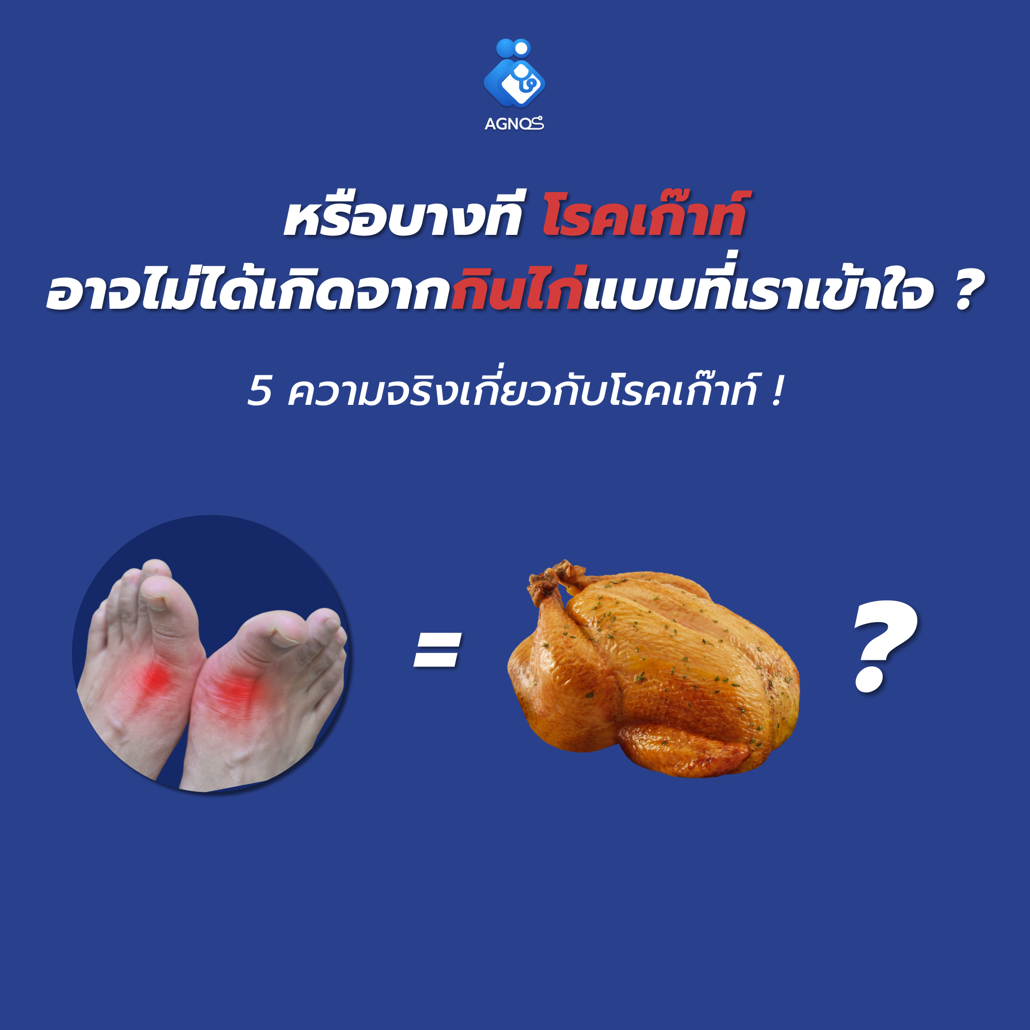 หรือบางที โรคเก๊าท์ อาจไม่ได้เกิดจากกินไก่แบบที่เราเข้าใจ ?