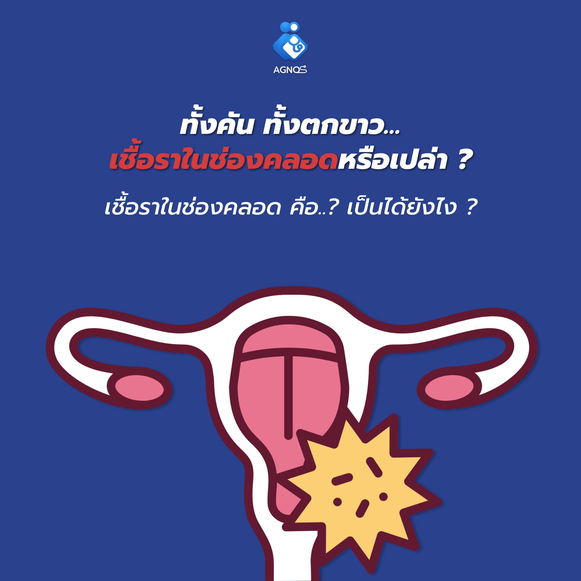 ทั้งคัน ทั้งตกขาว…เชื้อราในช่องคลอดหรือเปล่า ?