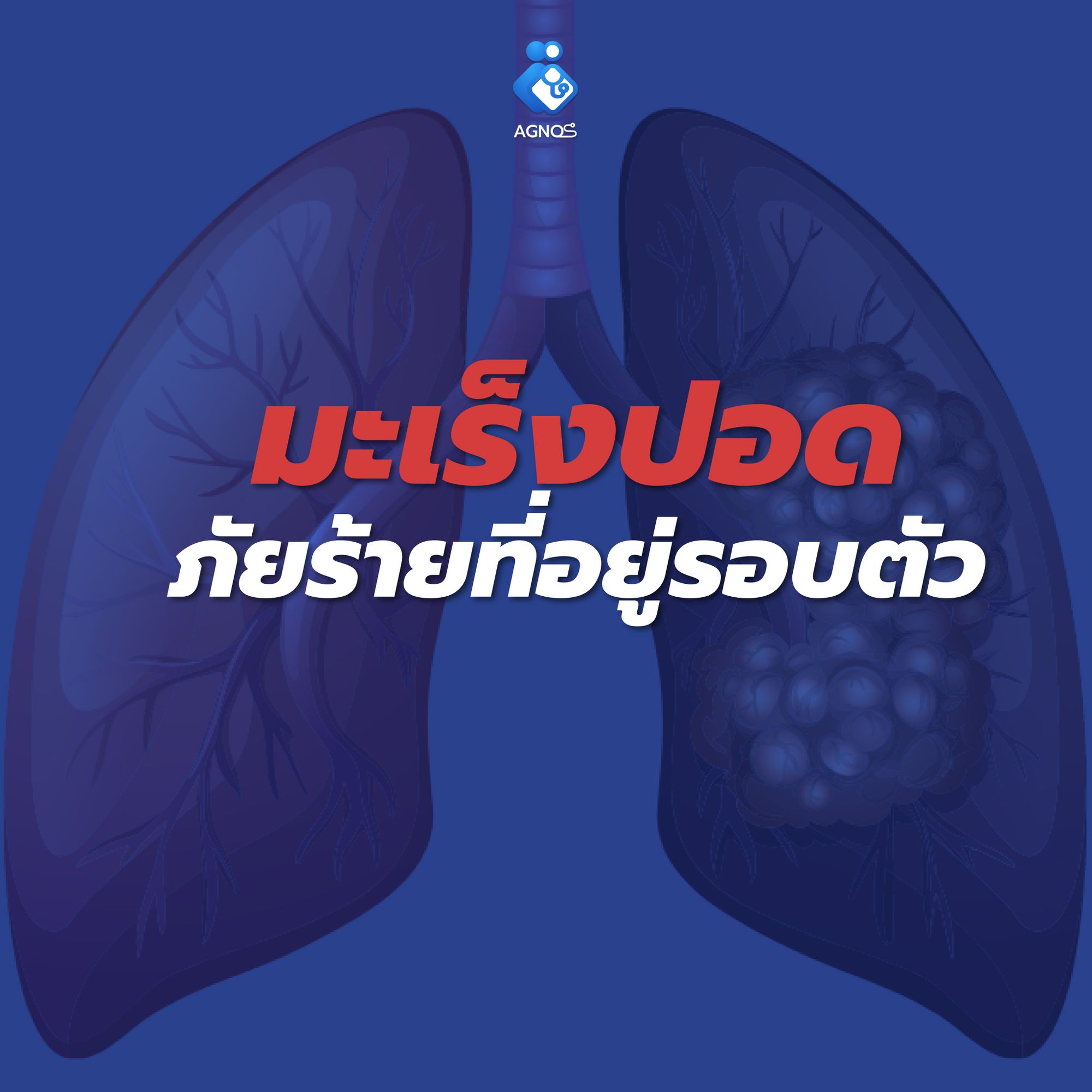 มะเร็งปอด ภัยร้ายที่อยู่รอบตัว