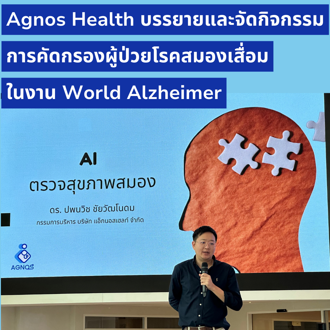 Agnos AI สมองเสื่อม Alzheimer