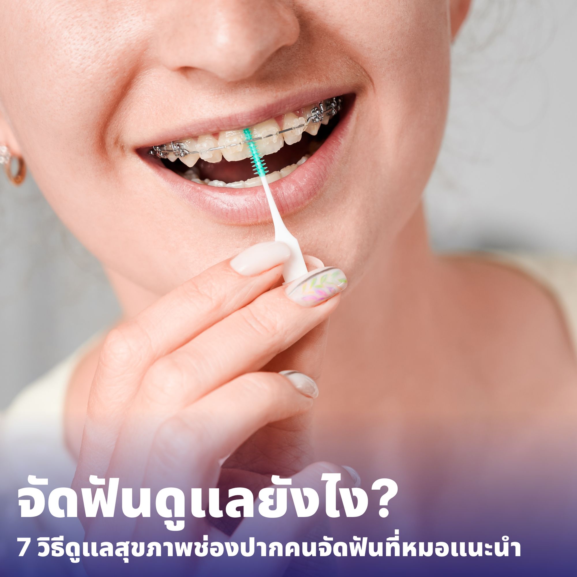 How to Take Care of Your Braces: 7 Dentist-Recommended Tips for Maintaining Oral Health