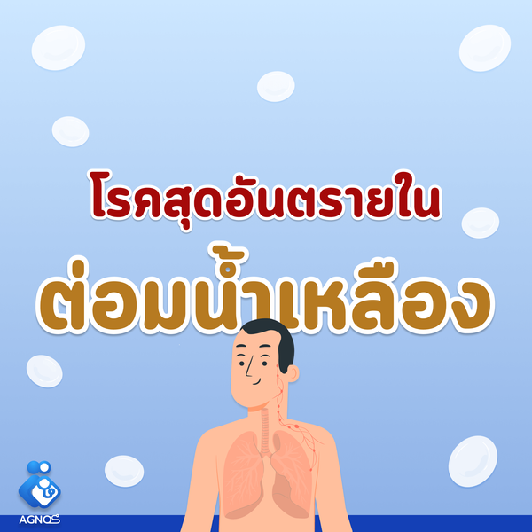 โรคสุดอันตรายใน ต่อมน้ำเหลือง