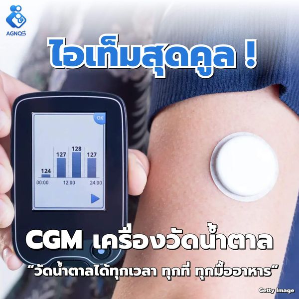 วัดน้ำตาลในเลือด ด้วยเครื่อง CGM