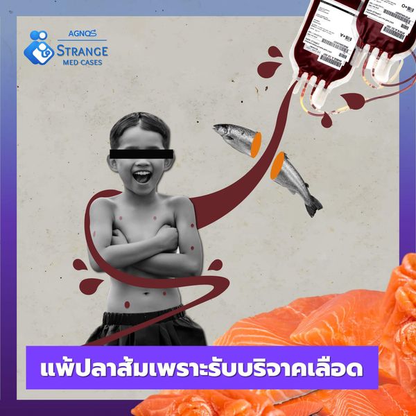 แพ้แซลมอน
