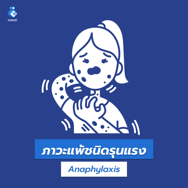 ภาวะแพ้ชนิดรุนแรง (Anaphylaxis)