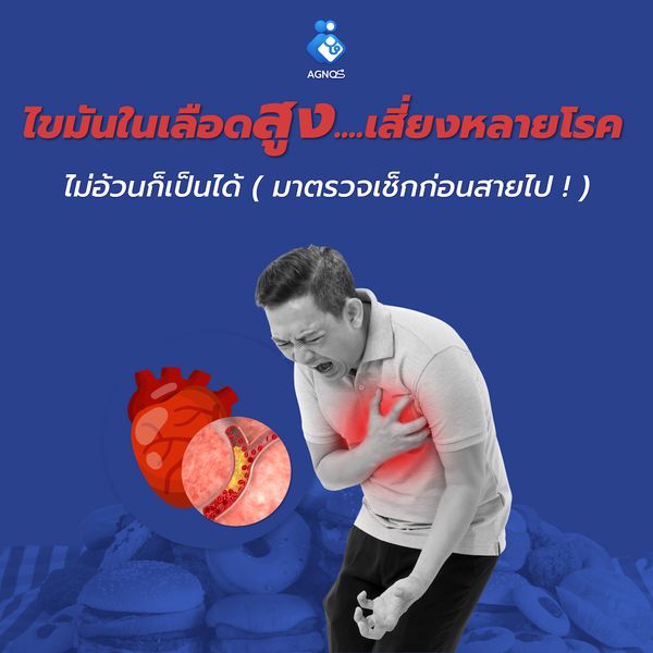 ไขมันในเลือด
