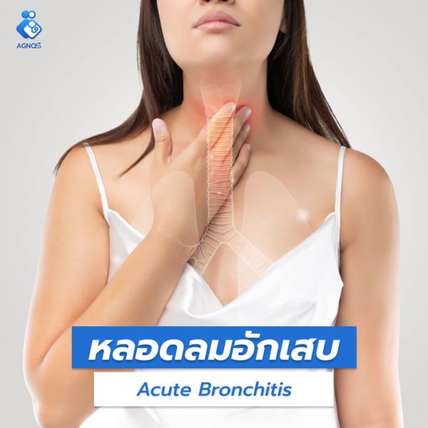 หลอดลมอักเสบ (Acute
Bronchitis)