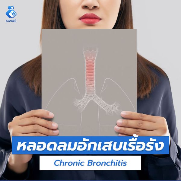 หลอดลมอักเสบเรื้อรัง (Chronic
Bronchitis)