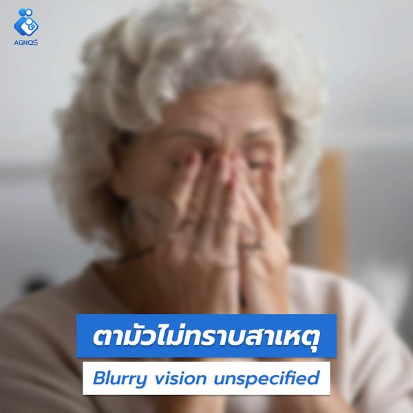 ตามัวไม่ทราบสาเหตุ
(Blurry vision unspecified)