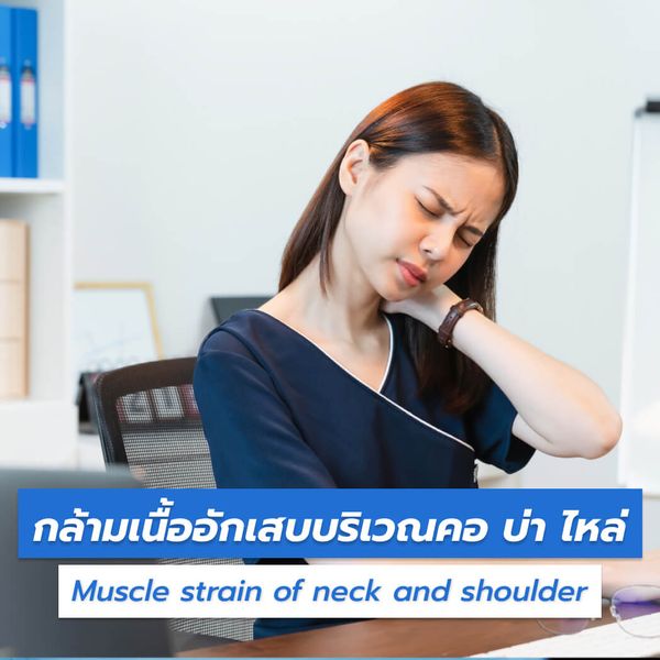 กล้ามเนื้ออักเสบบริเวณคอ
บ่า ไหล่ (Muscle strain of neck and shoulder)