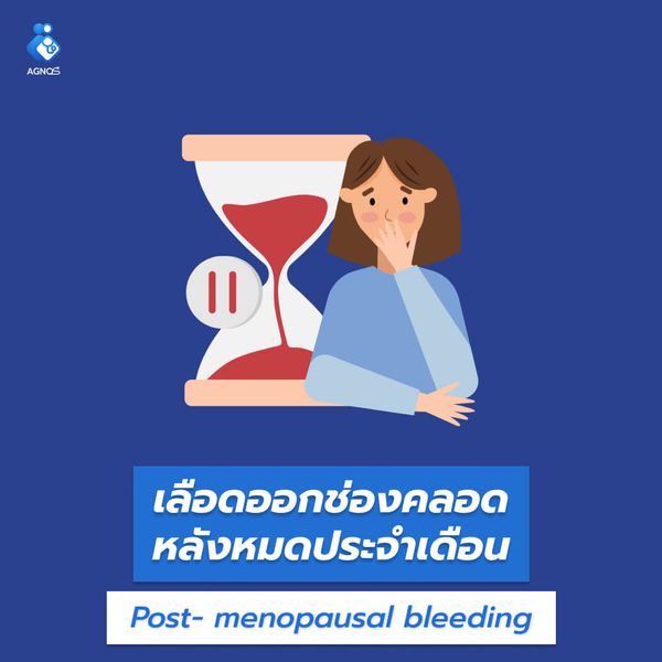 เลือดออกช่องคลอดหลังหมดประจำเดือน
(Post- menopausal bleeding unspecified)