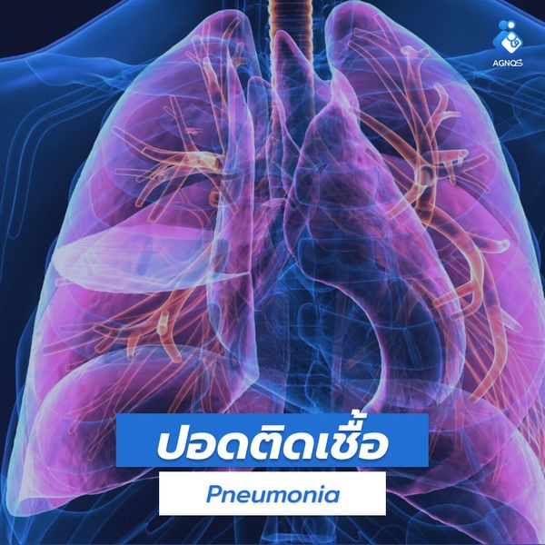 ปอดติดเชื้อ (Pneumonia)