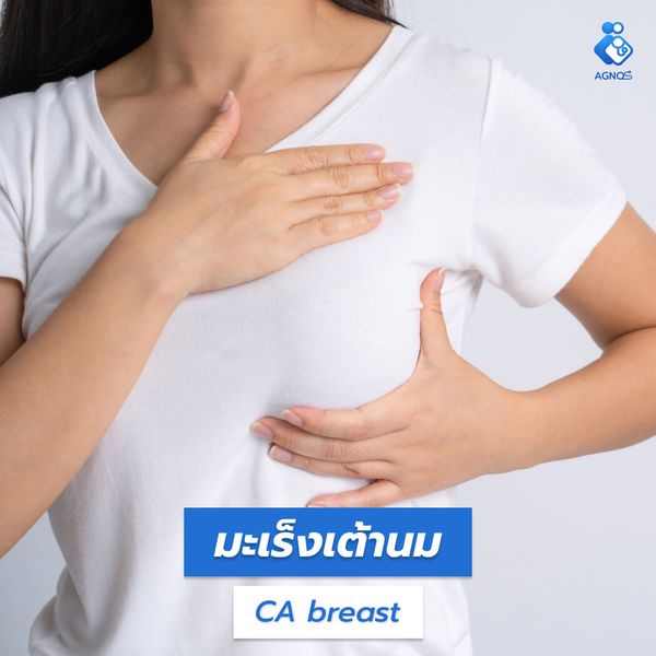 มะเร็งเต้านม (Breast cancer)