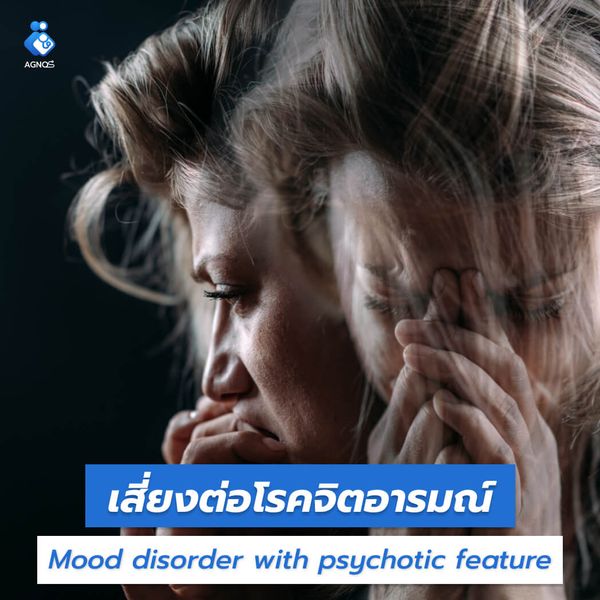โรคจิตอารมณ์
(Mood disorder with psychotic feature unspecified)