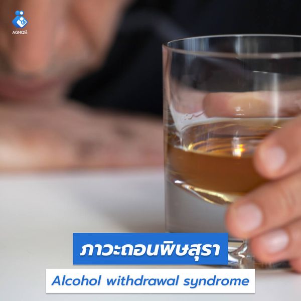 ภาวะถอนพิษสุรา (Alcohol
withdrawal syndrome)