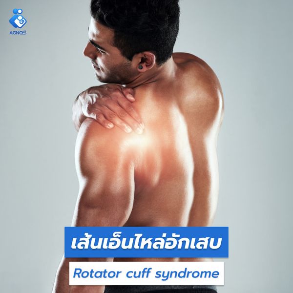 เส้นเอ็นไหล่อักเสบ (Rotator
cuff syndrome)