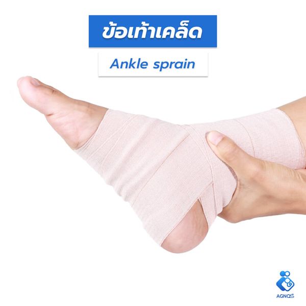 ข้อเท้าเคล็ด (Ankle sprain
unspecified)