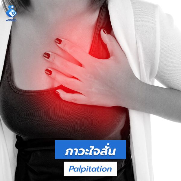 ภาวะใจสั่น (Palpitation)