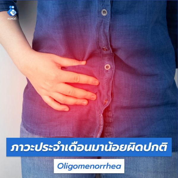 ภาวะประจำเดือนมาน้อยผิดปกติ (Oligomenorrhea)
