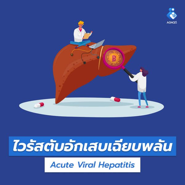 ไวรัสตับอักเสบเฉียบพลัน
(Acute Viral Hepatitis)