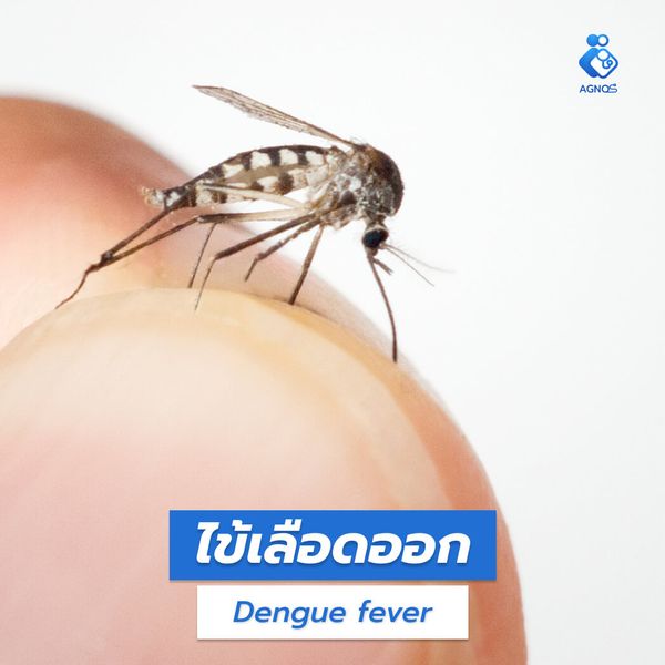 ไข้เลือดออก (Dengue fever)