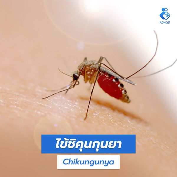 ไข้ชิคุนกุนยา (Chikungunya)