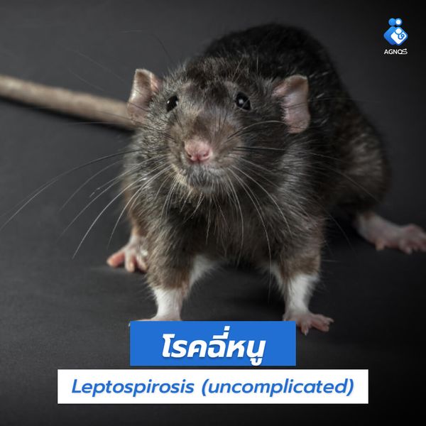 โรคฉี่หนู (Leptospirosis
(uncomplicated))